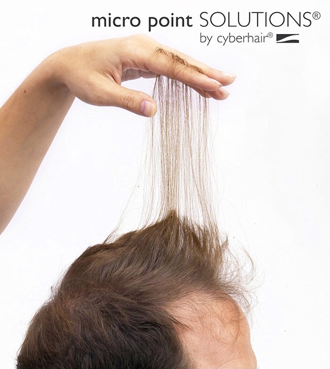 Portland Men's Hair Replacement Example